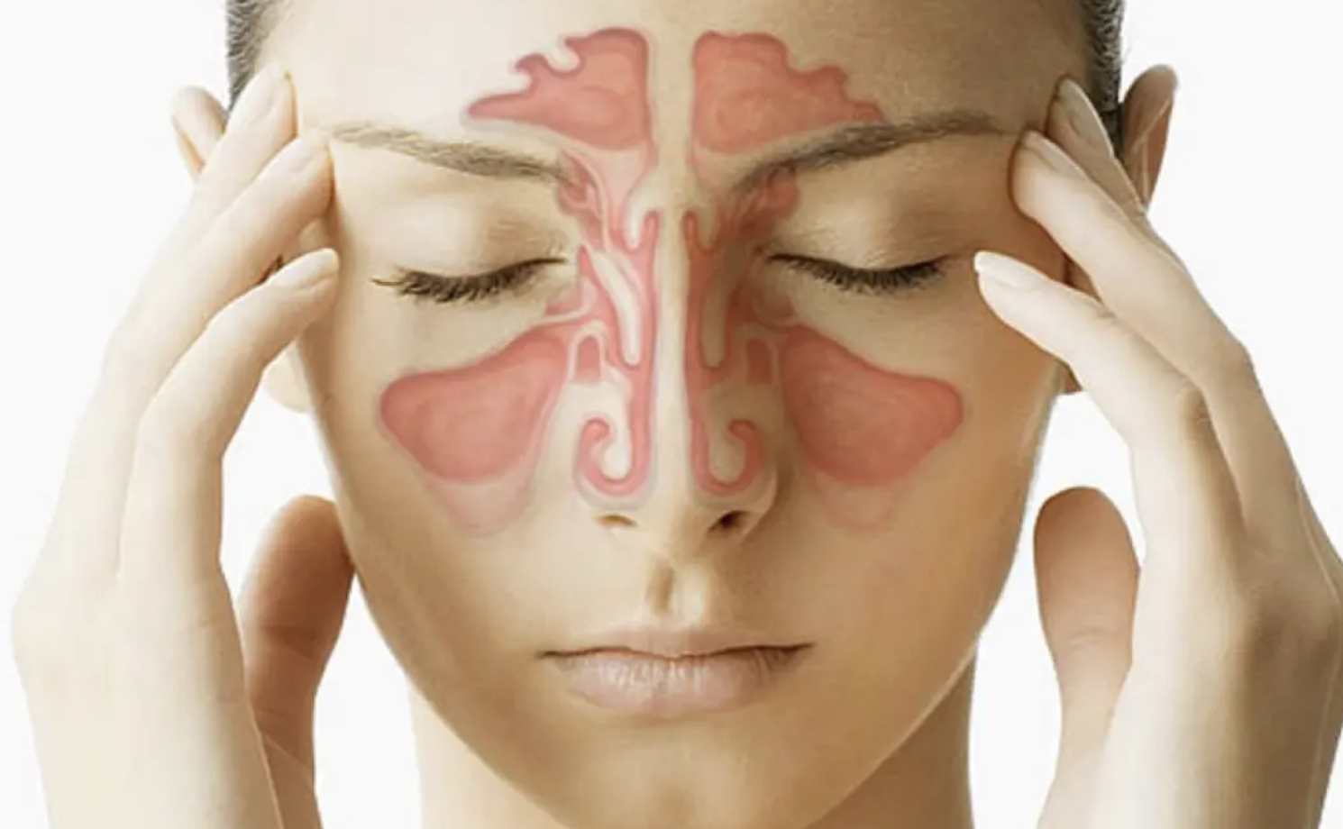 【补充剂方】- 鼻炎、鼻窦感染和肺部感染