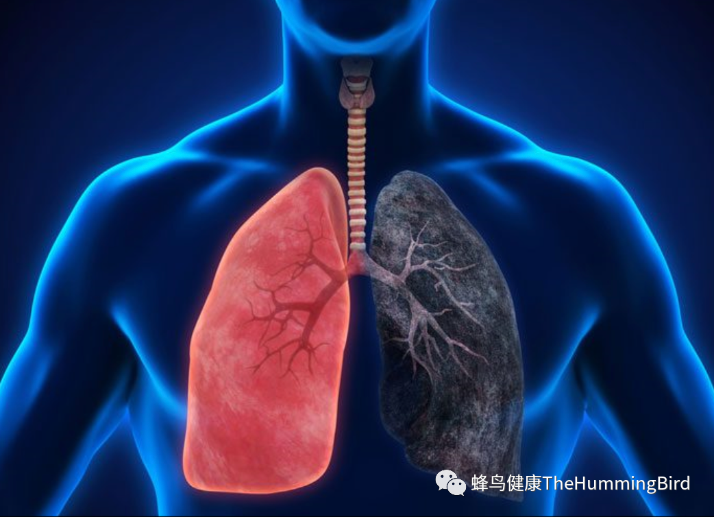 慢性阻塞性肺病 COPD（肺气肿）