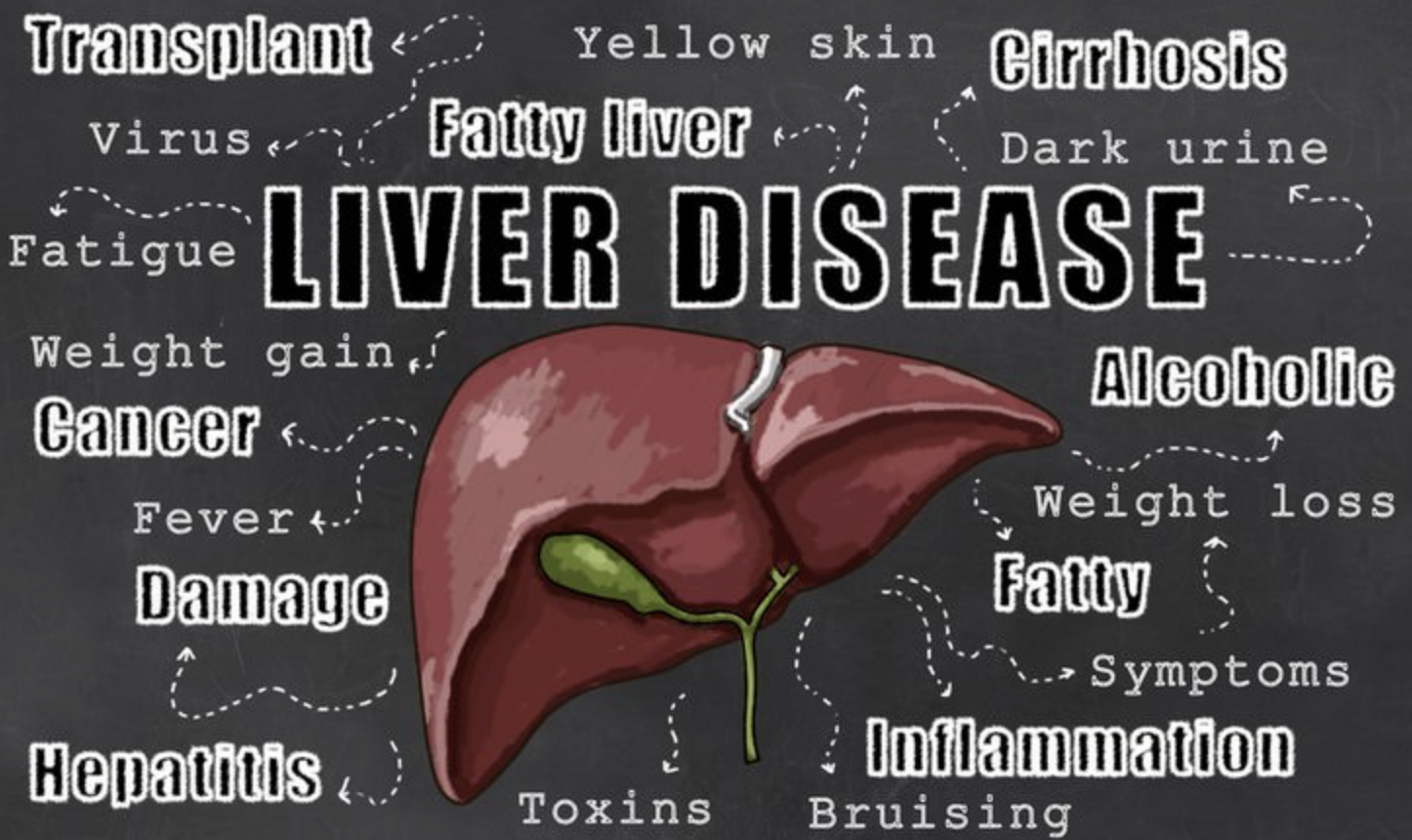 liver disease.png