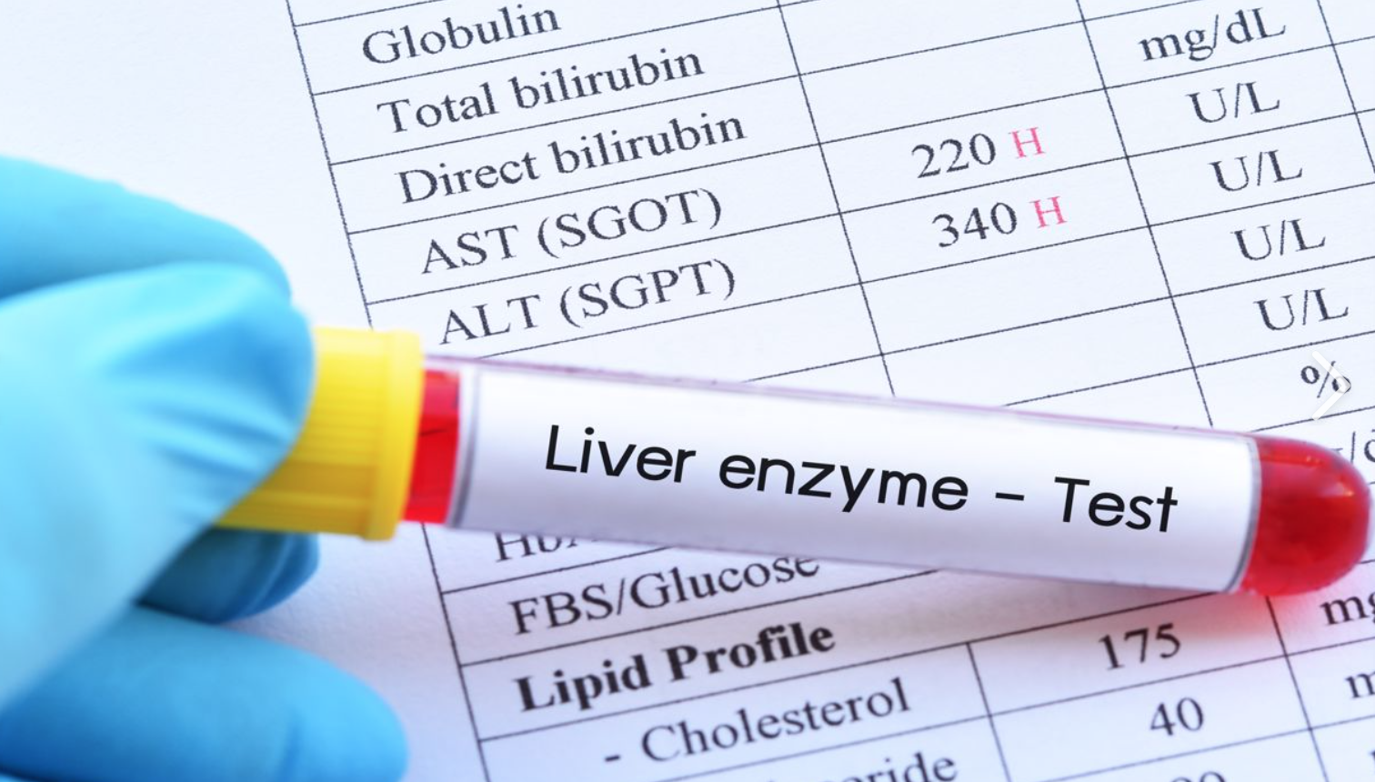 liver enzyme test.png