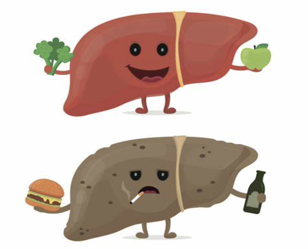 fatty liver 2.png