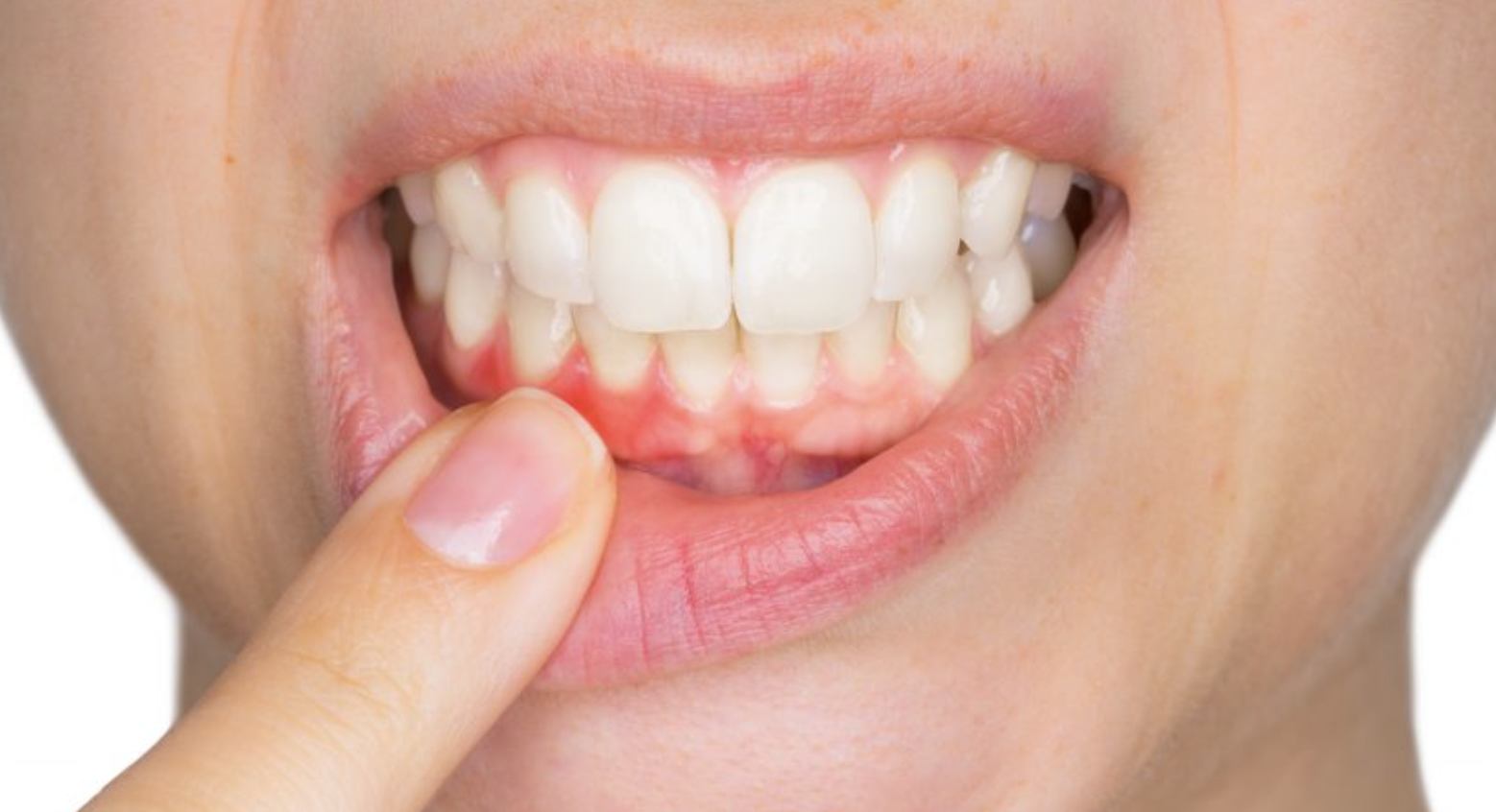 口腔健康（牙龈萎缩、牙龈问题、口气、龋齿（蛀牙）、三叉神经痛、根管治疗、汞填充物等）