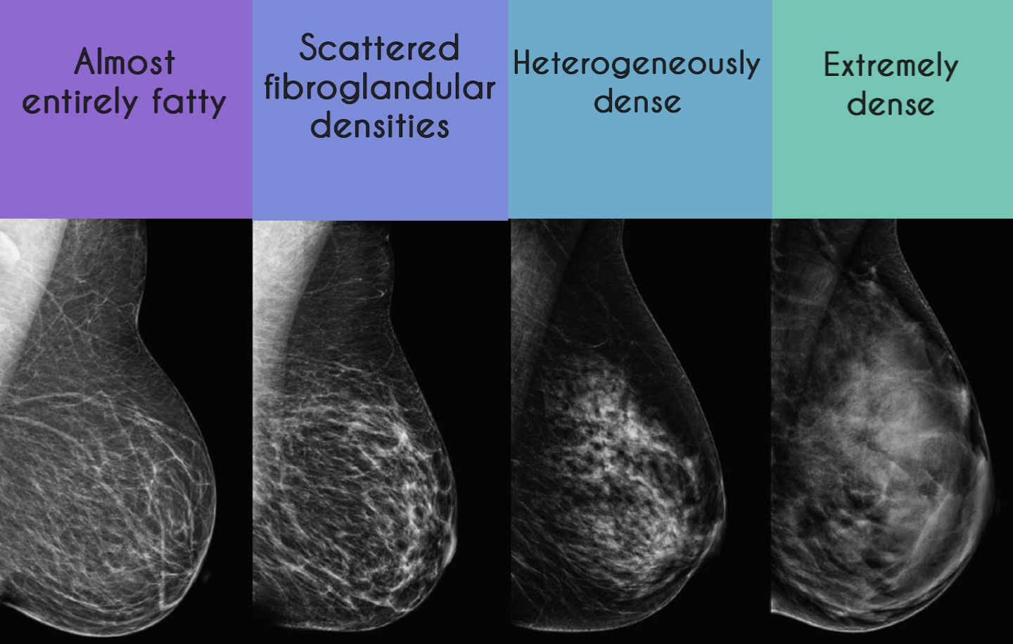 breast density.png