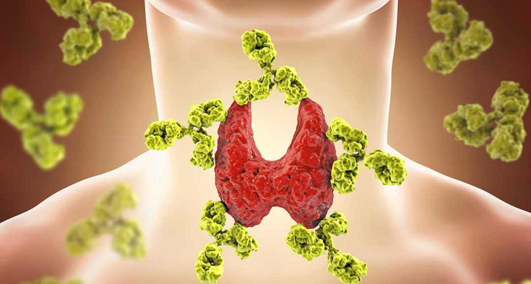 【疗愈案例】 甲状腺问题、肩膀和关节疼痛、腹胀、阳光过敏、唇疱疹等-图片2