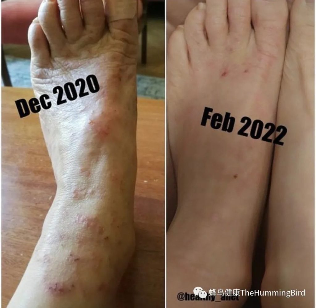 【疗愈案例】 疗愈不是一蹴而就的线性过程-图片1