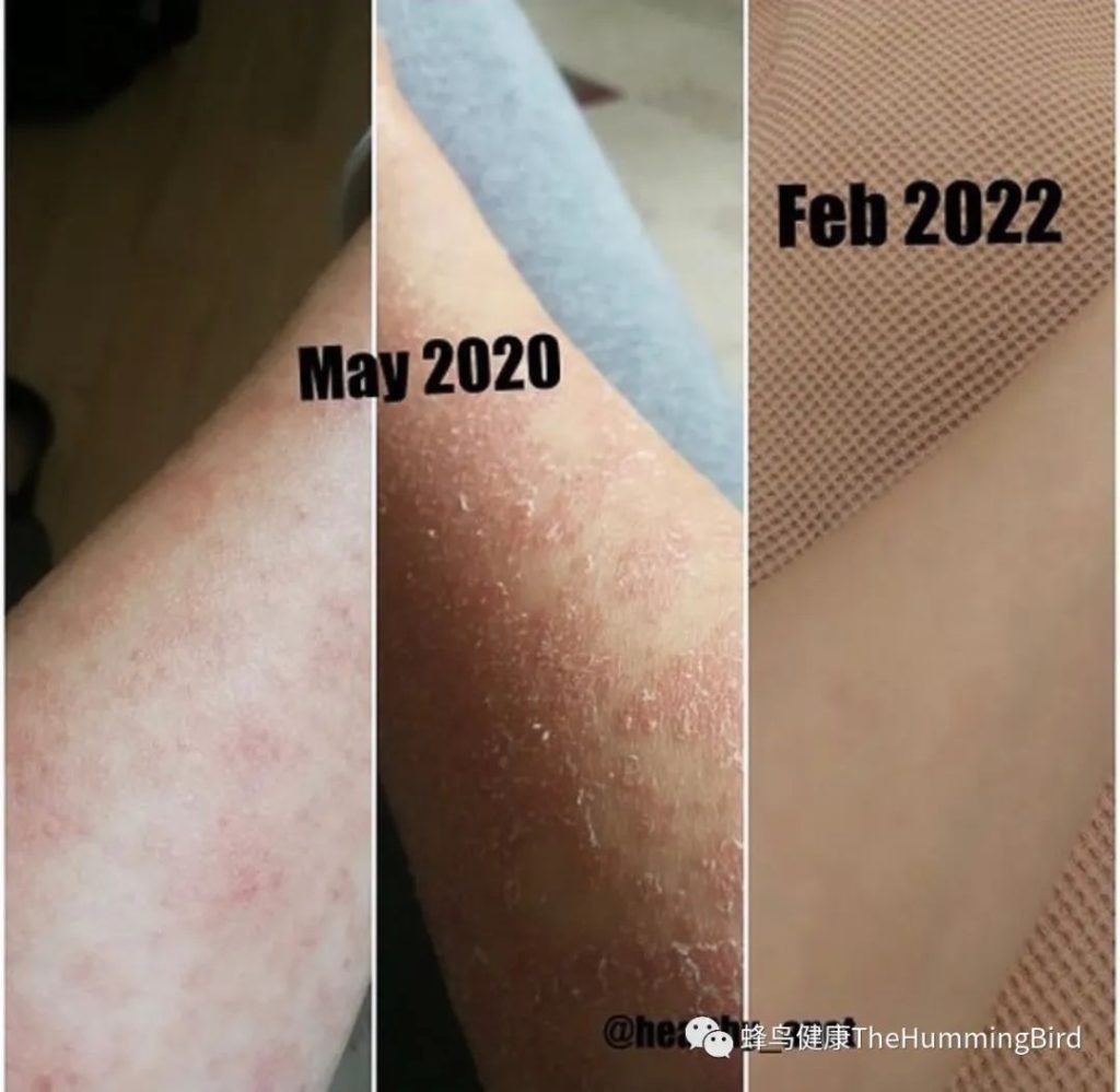 【疗愈案例】 疗愈不是一蹴而就的线性过程-图片1