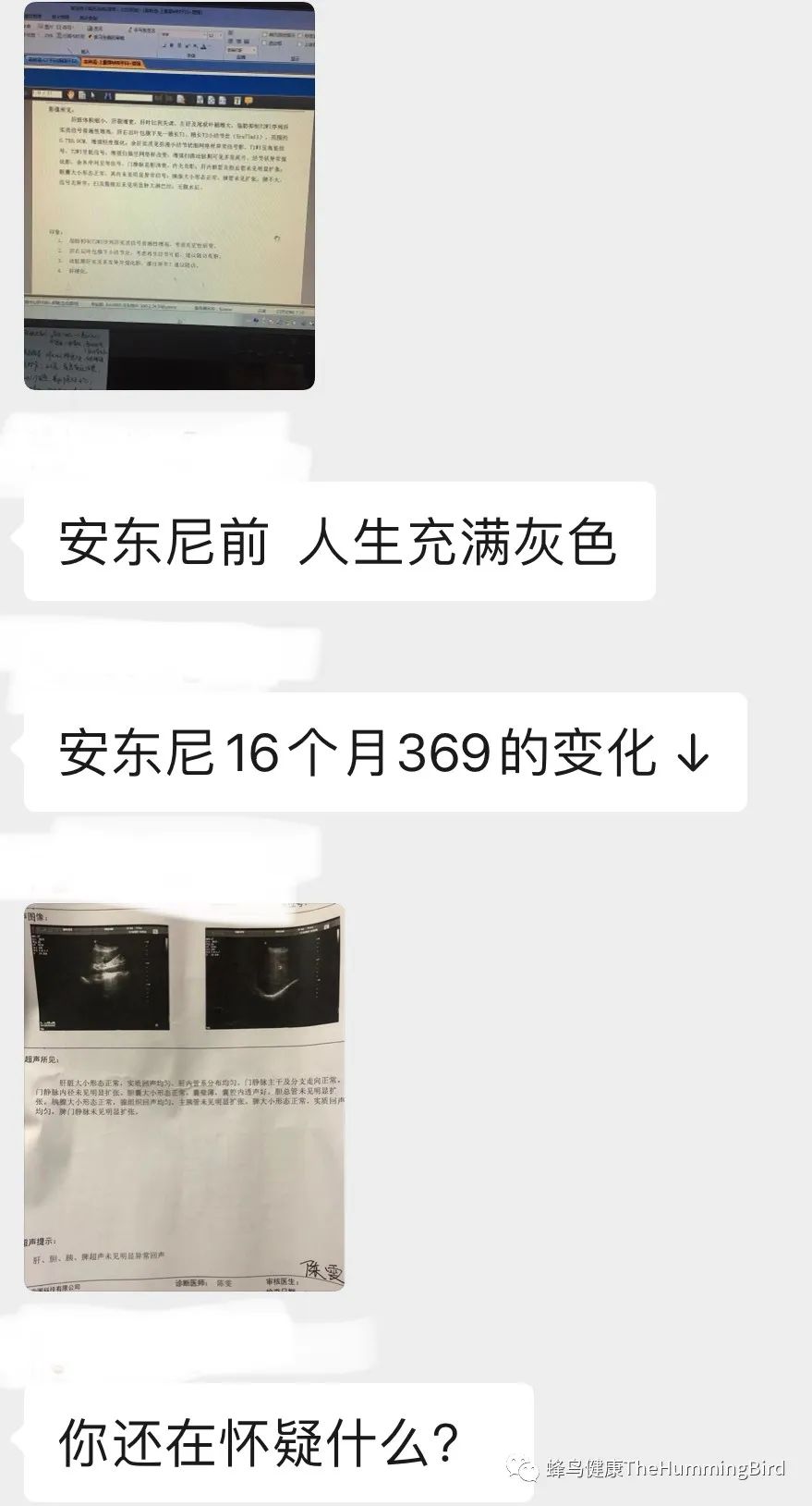 中国疗愈故事(9)- 告别死亡判决书(肝衰竭、肝硬化、重症肝炎)-图片8