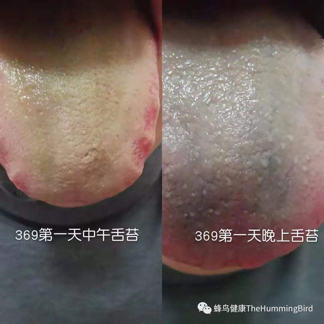 中国实践者们的排毒反应分享（疗愈反应、好转反应）-图片8