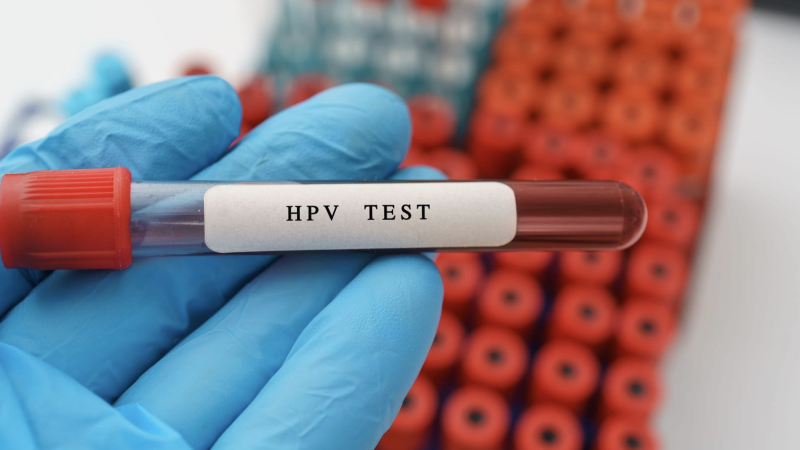 【补充剂方】- 人乳头瘤病毒 (HPV)