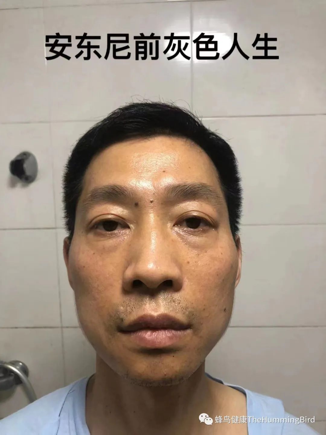 中国疗愈故事(9)- 告别死亡判决书(肝衰竭、肝硬化、重症肝炎)-图片4