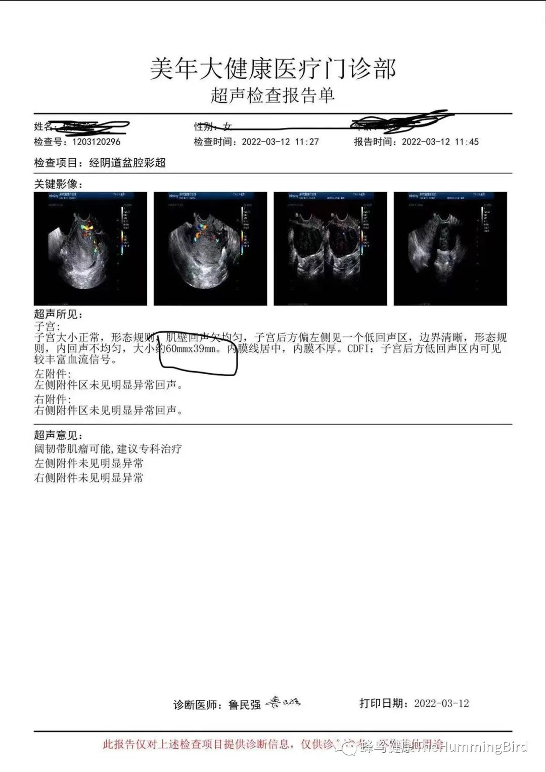 【疗愈案例】 子宫肌瘤
