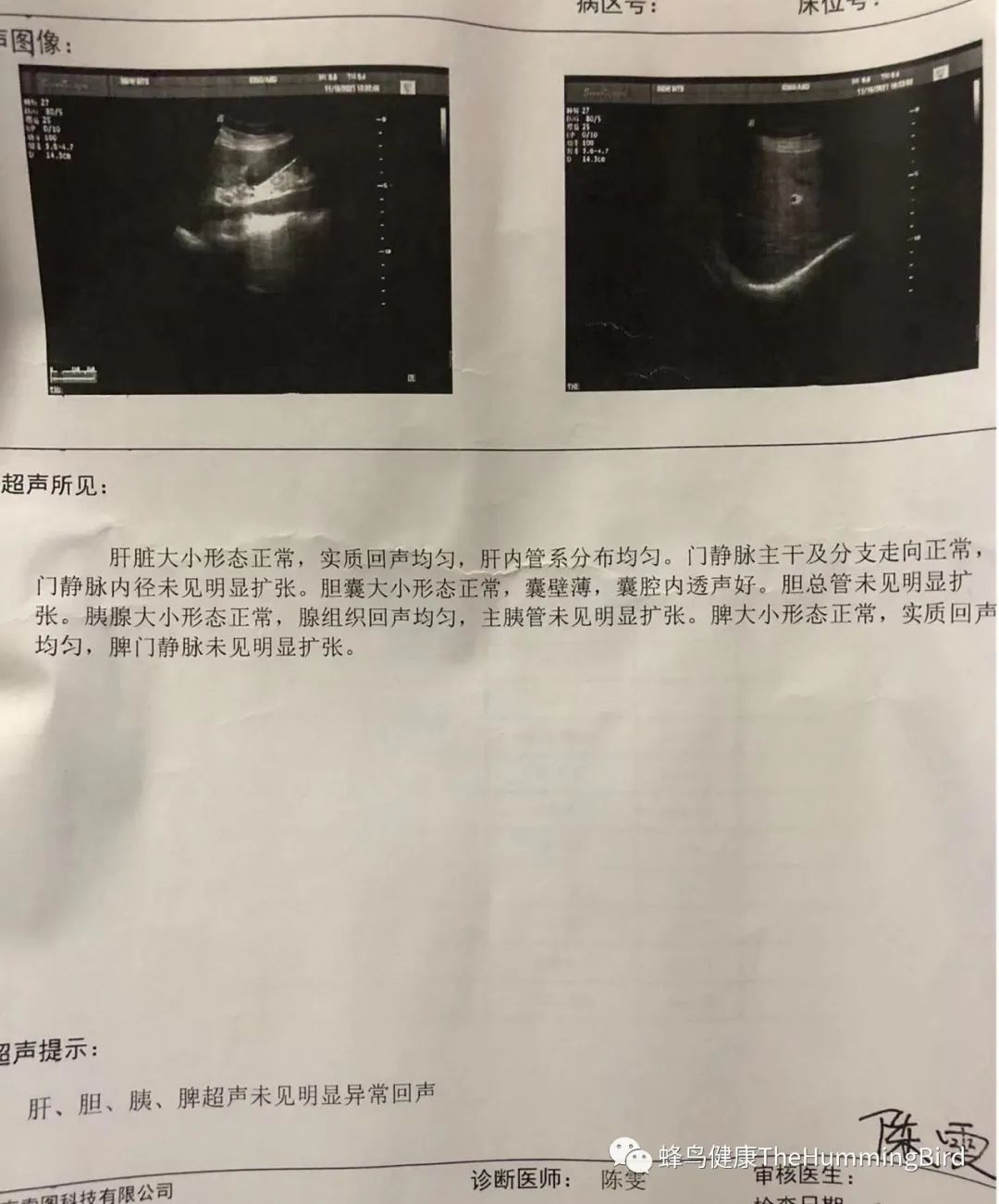 中国疗愈故事(9)- 告别死亡判决书(肝衰竭、肝硬化、重症肝炎)-图片10