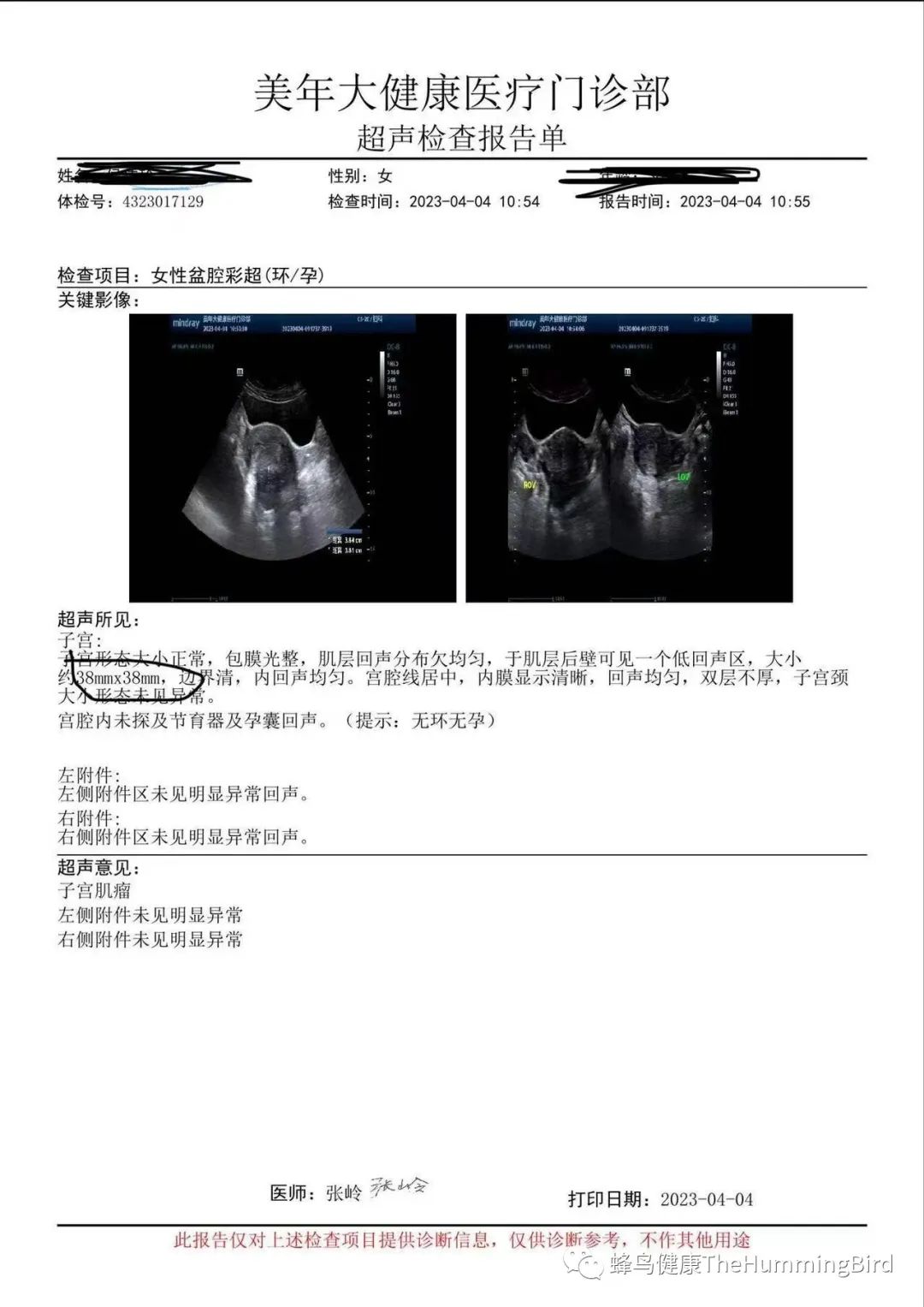 【疗愈案例】 子宫肌瘤