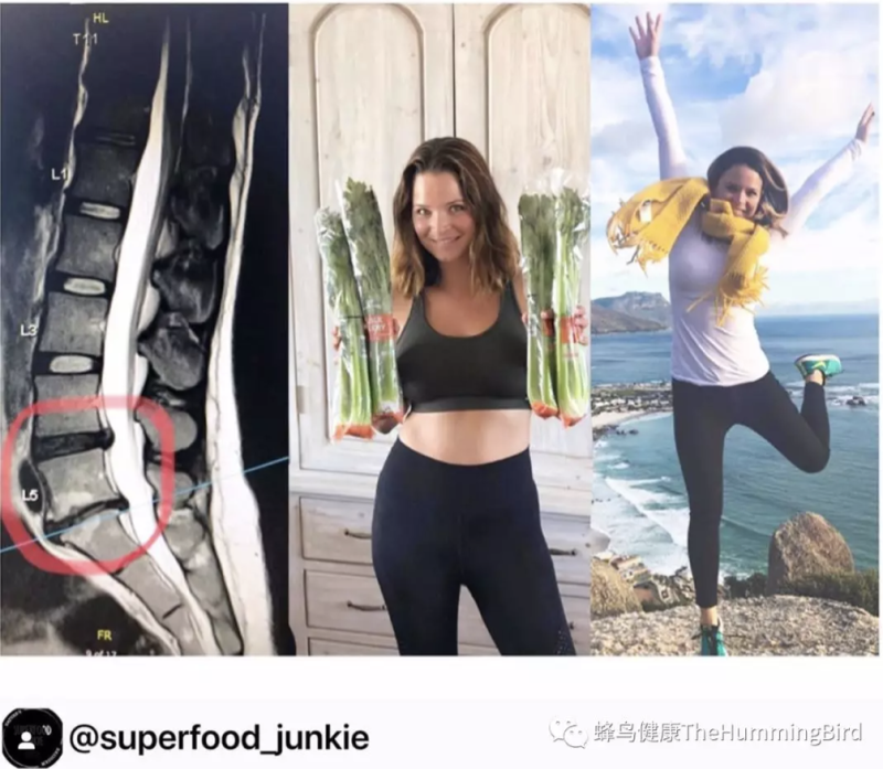 【疗愈案例】子宫内膜异位症、腰间盘突出、不孕症-图片1