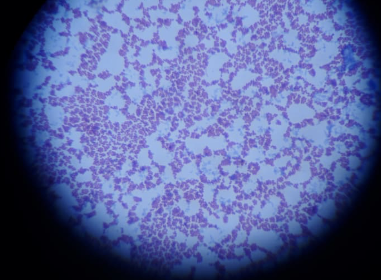 各类慢性疾病背后的真凶（五）- 链球菌 Streptococcus Revealed